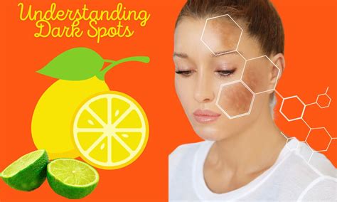 wellhealthorganic.com/easily-remove-dark-spots-lemon-juice|Discover the Power of Lemon Juice in Removing Dark Spots